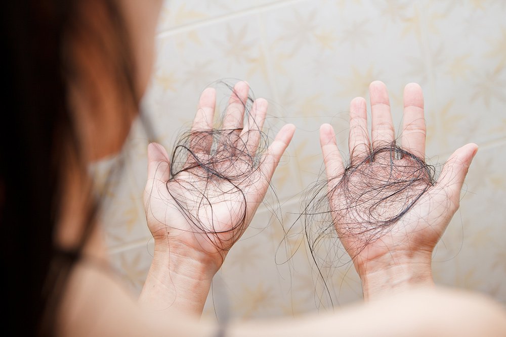 Stress causing hair loss in female