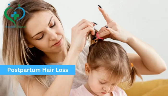 Postpartum Hair Loss