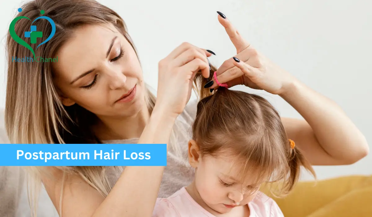 Postpartum Hair Loss