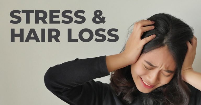 Hair loss due to stress in women