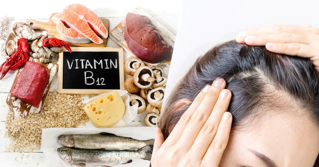 Vitamin B12 Hair Loss