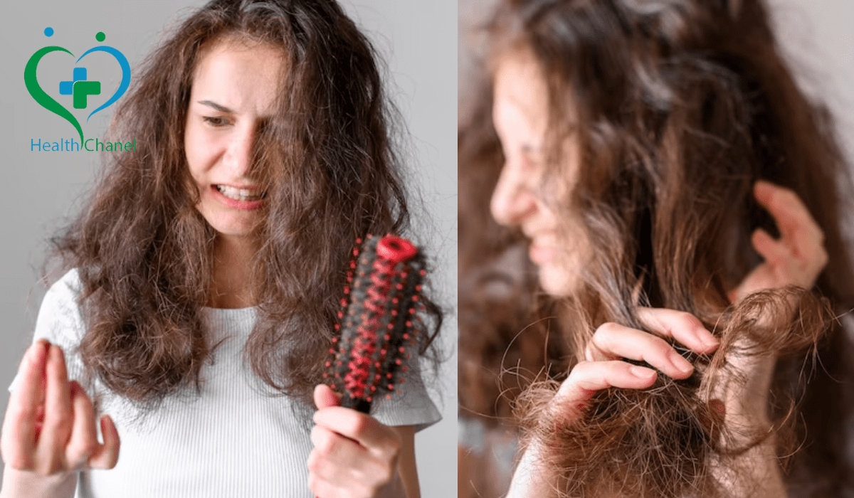 Postpartum Hair Loss