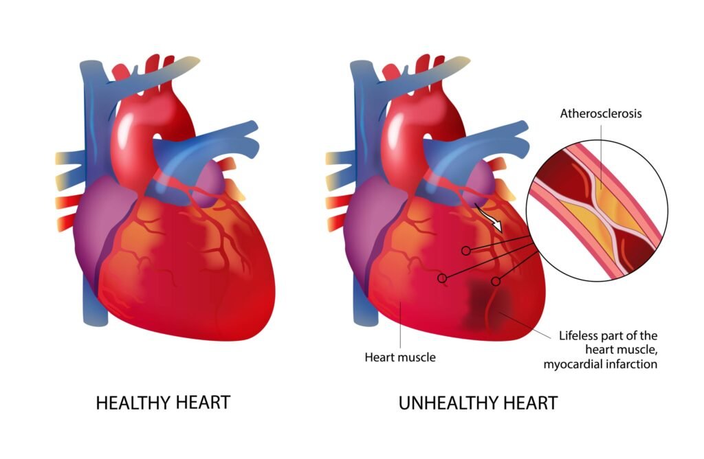 Signs of Unhealthy heart