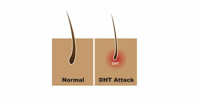 Creatine effect on DHT