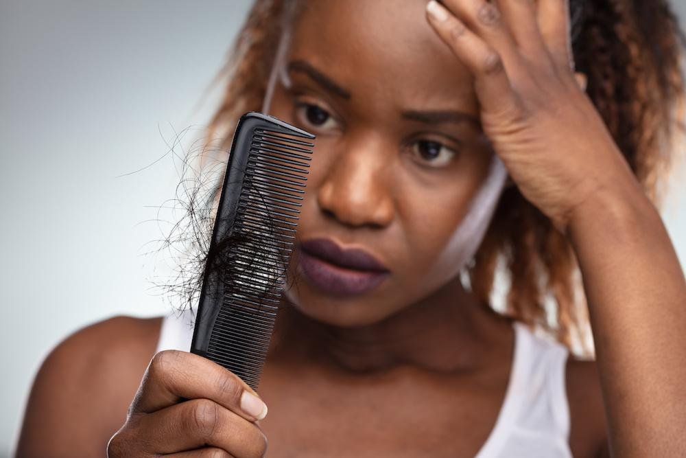 hair loss treatment for female