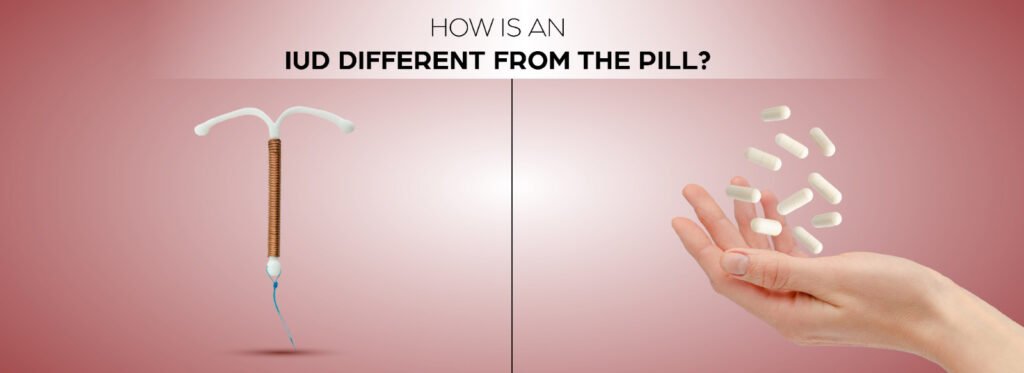 Is an IUD better than birth control pills?