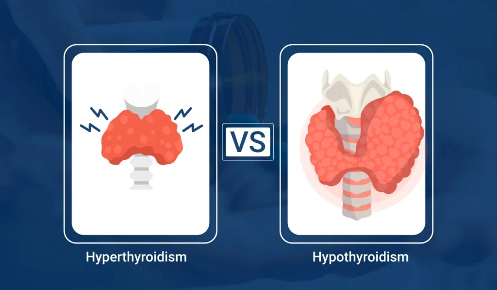 Hyperthyroidism and Hypothyroidism difference