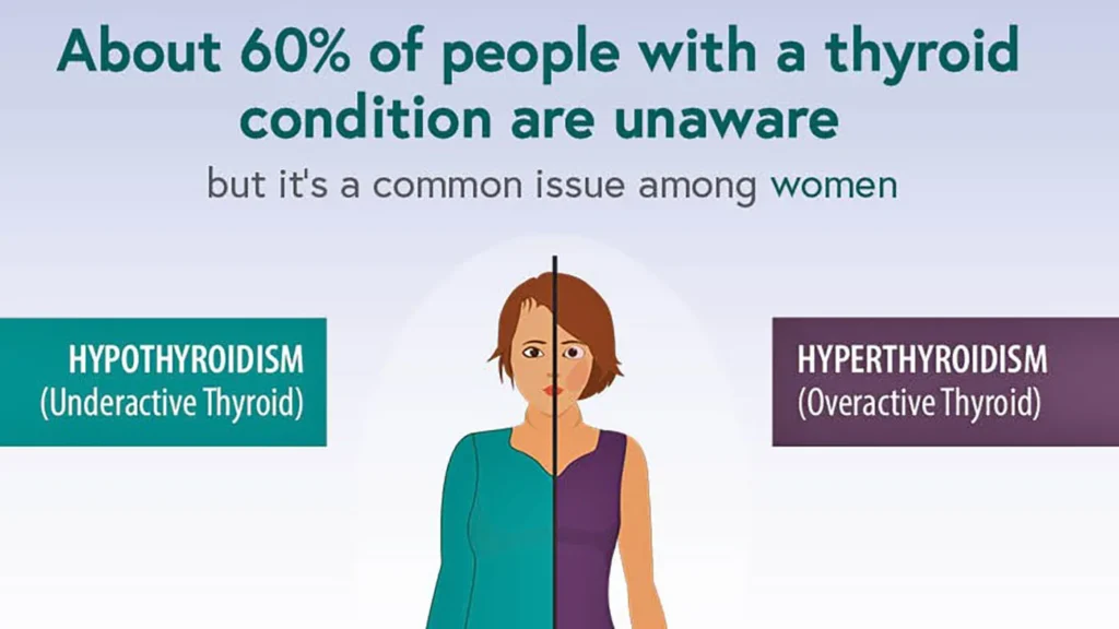 Thyroid disease in women