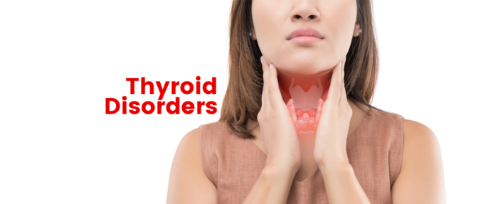 Thyroid Disorders In Female