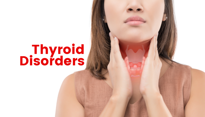 Thyroid Disorders In Female