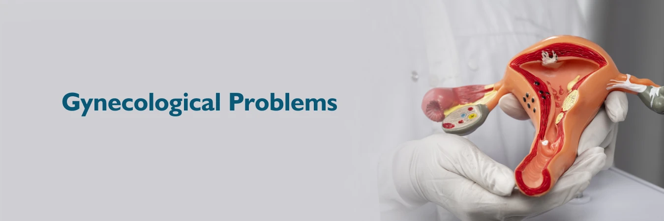 10 Common Gynecological Problems and How to Prevent Them