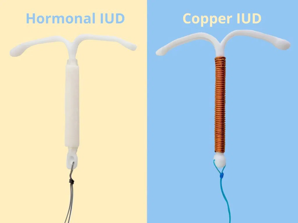 Types of IUD